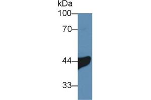 Detection of IL3Ra in Human A549 cell lysate using Polyclonal Antibody to Interleukin 3 Receptor Alpha (IL3Ra) (IL3RA Antikörper  (AA 167-331))