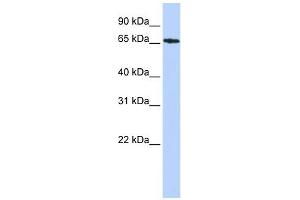 SDCCAG8 antibody used at 1 ug/ml to detect target protein. (SDCCAG8 Antikörper  (Middle Region))