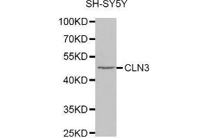 Western blot analysis of extracts of SH-SY5Y cell line, using CLN3 antibody. (CLN3 Antikörper  (AA 1-280))