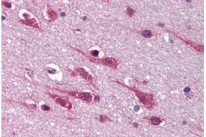 Human Brain, Cortex (formalin-fixed, paraffin-embedded) stained with MAPK9 antibody ABIN292321 at 20 ug/ml followed by biotinylated goat anti-rabbit IgG secondary antibody ABIN481713, alkaline phosphatase-streptavidin and chromogen. (JNK2 Antikörper  (C-Term))