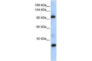 WB Suggested Anti-TUT1 Antibody Titration:  0. (TUT1 Antikörper  (Middle Region))