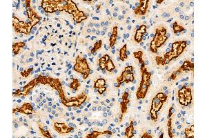 ABIN6259928 and ABIN6276407 at 1/100 staining Rat kidney tissue by IHC-P. (Angiopoietin 2 Antikörper  (N-Term))