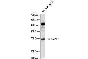 Western blot analysis of extracts of mouse thymus, using IP5 antibody (ABIN7265499) at 1:1000 dilution. (ARL6IP5 Antikörper  (C-Term))