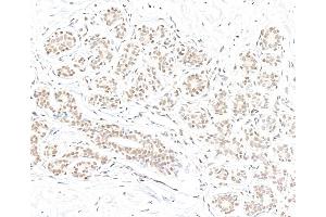 anti-BRCA1 Associated Protein-1 (Ubiquitin Carboxy-terminal Hydrolase) (BAP1) (AA 475-525) antibody