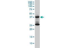 DNAJB6 monoclonal antibody (M01), clone 2C11-C1 Western Blot analysis of DNAJB6 expression in Jurkat . (DNAJB6 Antikörper  (AA 1-241))