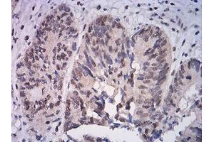 Immunohistochemistry (IHC) image for anti-Activating Transcription Factor 4 (Tax-Responsive Enhancer Element B67) (ATF4) (AA 212-351) antibody (ABIN5542583)