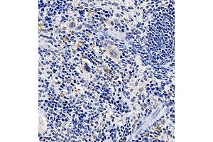 Immunohistochemistry of paraffin embedded mouse spleen using TREML1 (ABIN7076009) at dilution of 1:2200 (400x lens)