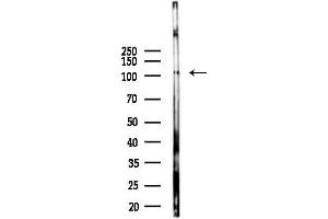 anti-Transmembrane Protein 67 (TMEM67) (Internal Region) antibody