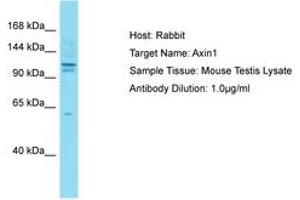 Image no. 1 for anti-Axin 1 (AXIN1) (AA 8-62) antibody (ABIN6750309) (Axin Antikörper  (AA 8-62))
