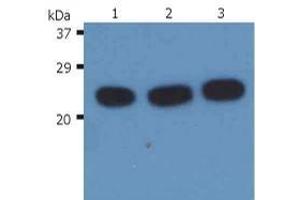 Western Blotting (WB) image for anti-HRas proto-oncogene, GTPase (HRAS) antibody (ABIN238418) (HRAS Antikörper)