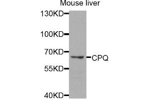 Western blot analysis of extracts of mouse liver cells, using CPQ antibody. (CPQ Antikörper)