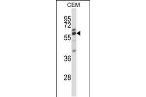 Western blot analysis in CEM cell line lysates (35ug/lane). (CORO2A Antikörper  (AA 185-213))