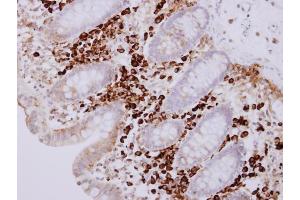IHC-P Image PACAP antibody [N1C3] detects PACAP protein at cytosol on human normal colon mucosa with lymphocyte by immunohistochemical analysis. (MZB1 Antikörper)