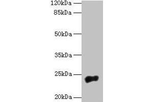 Western blot All lanes: NACA2 antibody at 5 μg/mL + 293T whole cell lysate Secondary Goat polyclonal to rabbit IgG at 1/10000 dilution Predicted band size: 24 kDa Observed band size: 24 kDa (NACA2 Antikörper  (AA 1-215))