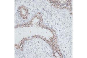 Immunohistochemistry of paraffin-embedded human breast using NOL3 antibody.