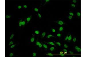 Immunofluorescence of monoclonal antibody to HEYL on HeLa cell.