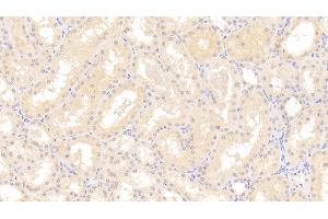 Immunohistochemistry (IHC) image for anti-Nuclear Receptor Subfamily 3, Group C, Member 2 (NR3C2) (AA 739-984) antibody (ABIN7431818)