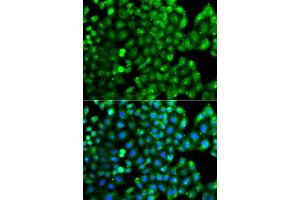 Immunofluorescence analysis of A549 cells using HLA-DRB1 antibody (ABIN5975721). (HLA-DRB1 Antikörper)