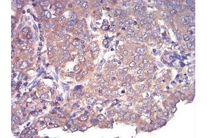 Immunohistochemistry (IHC) image for anti-Complement Factor H-Related 5 (CFHR5) (AA 344-569) antibody (ABIN5542639)
