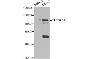 Western Blotting (WB) image for anti-Rac GTPase Activating Protein 1 (RACGAP1) antibody (ABIN1876486) (RACGAP1 Antikörper)