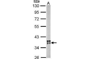 Western Blotting (WB) image for anti-Malate Dehydrogenase 2, NAD (Mitochondrial) (MDH2) antibody (ABIN2856204)