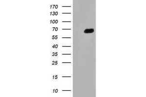HEK293T cells were transfected with the pCMV6-ENTRY control (Left lane) or pCMV6-ENTRY AFP (Right lane) cDNA for 48 hrs and lysed. (alpha Fetoprotein Antikörper)