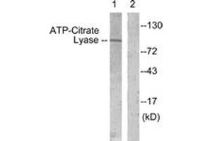Western blot analysis of extracts from COS7 cells, treated with Calyculin 50nM 30', using ATP-Citrate Lyase (Ab-454) Antibody. (ACLY Antikörper  (AA 420-469))