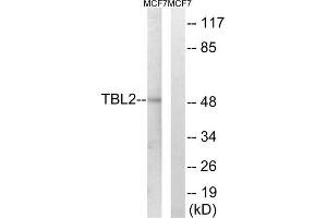 Western blot analysis of extracts from MCF-7 cells, using TBL2 antibody. (TBL2 Antikörper  (C-Term))