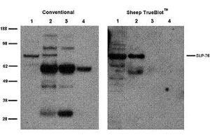 Sheep IP / Western Blot Sheep IP / Western Blot: Jurkat cell lysate (500 µg) was incubated with 2 µg of sheep anti-SLP76 and immunoprecipitated using Protein G. (Schaf TrueBlot® Anti-Schaf IgG HRP)