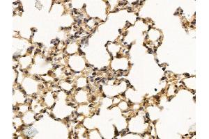 ABIN7094756 and ABIN7098807 at 1/100 staining Mouse lung tissue by IHC-P. (MED16 Antikörper  (Internal Region))