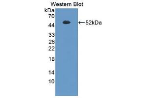 Western blot analysis of the recombinant protein. (SFTPB Antikörper  (AA 201-381))