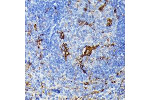 Immunohistochemistry of paraffin-embedded mouse spleen using TI antibody (ABIN6133213, ABIN6149144, ABIN6149145 and ABIN6221696) at dilution of 1:100 (40x lens). (TIAL1 Antikörper  (AA 266-375))