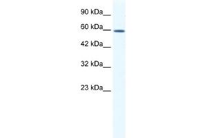 WB Suggested Anti-DDX5 Antibody Titration:  1. (DDX5 Antikörper  (C-Term))