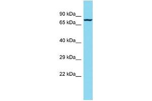 Host: Rabbit Target Name: TTLL12 Sample Type: MCF7 Whole Cell lysates Antibody Dilution: 1. (TTLL12 Antikörper  (N-Term))