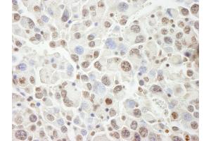 Immunohistochemistry (IHC) image for anti-PHD Finger Protein 6 (PHF6) (AA 125-175) antibody (ABIN7448999) (PHF6 Antikörper  (AA 125-175))