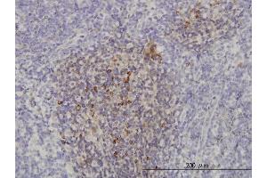 Immunoperoxidase of monoclonal antibody to PIK3CB on formalin-fixed paraffin-embedded human lymph node.