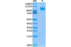 IL13 Receptor alpha 1 Protein (AA 27-343) (Fc Tag)