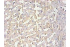Immunohistochemical of paraffin-embedded human liver tissue using ABIN7165035 at dilution of 1:200 (AMBP Antikörper)
