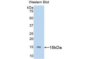 Detection of Recombinant CD59, Rat using Polyclonal Antibody to Cluster of Differentiation 59 (CD59) (CD59 Antikörper  (AA 23-105))