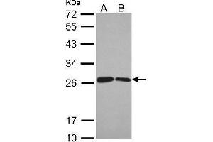WB Image Sample (30 ug of whole cell lysate) A: Jurkat B: Raji 12% SDS PAGE antibody diluted at 1:1000