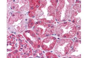 Immunohistochemistry (IHC) image for anti-Signal Transducer and Activator of Transcription 3 (Acute-Phase Response Factor) (STAT3) (N-Term) antibody (ABIN2780479) (STAT3 Antikörper  (N-Term))