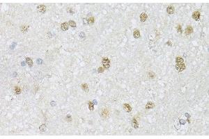 Immunohistochemistry of paraffin-embedded Mouse brain using CMAS Polyclonal Antibody at dilution of 1:150 (40x lens). (CMAS Antikörper)