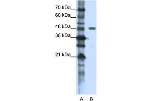 WB Suggested Anti-PPP1R8 Antibody Titration:  1. (PPP1R8 Antikörper  (N-Term))