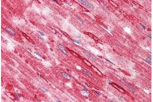 Human Heart: Formalin-Fixed, Paraffin-Embedded (FFPE) (TTYH2 Antikörper  (N-Term))