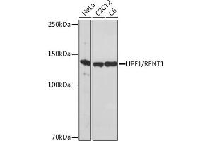 Western blot analysis of extracts of various cell lines, using UPF1/RENT1 Rabbit mAb (ABIN7271226) at 1:1000 dilution. (RENT1/UPF1 Antikörper)