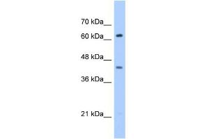 WB Suggested Anti-ZSCAN5D Antibody Titration:  0. (ZSCAN5D Antikörper  (Middle Region))