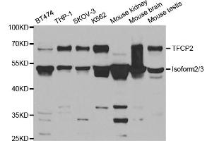 Western blot analysis of extracts of various cell lines, using TFCP2 antibody (ABIN5973236) at 1/1000 dilution. (TFCP2 Antikörper)