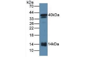 Figure. (SAA2 Antikörper  (AA 20-122))