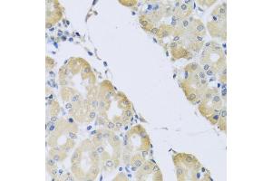 Immunohistochemistry of paraffin-embedded human stomach using C1 antibody (ABIN3016169, ABIN3016170, ABIN3016171 and ABIN6219598) at dilution of 1:100 (40x lens). (ATP2C1 Antikörper  (AA 400-660))