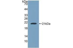 Detection of Recombinant NUP210, Human using Polyclonal Antibody to Nuclear Pore Glycoprotein 210 (gp210) (Nuclear Pore Glycoprotein 210 (AA 1288-1449) Antikörper)